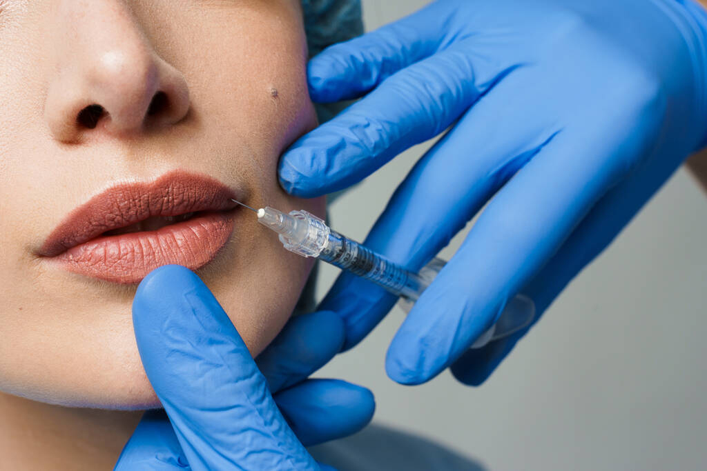 Científicos estudian a quién le gustan realmente los rellenos labiales